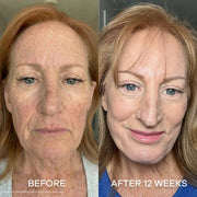 Dermly GHK-Cu Overnight Wrapping Mask