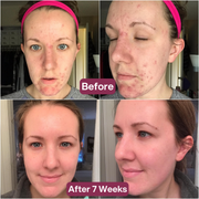 Snail 96 Mucin Mask (4 Masks)